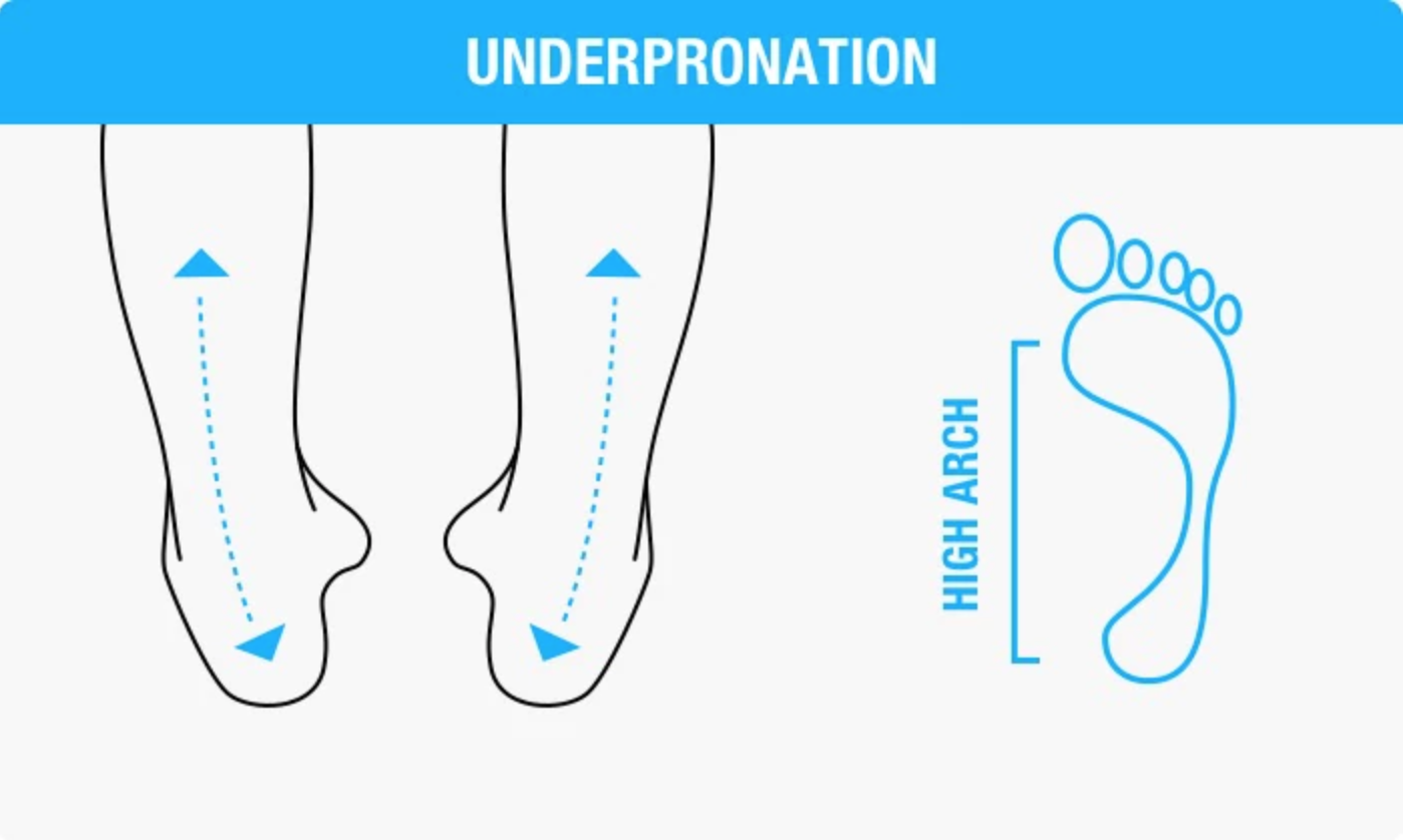 Pronation Guide: Finding the Right 