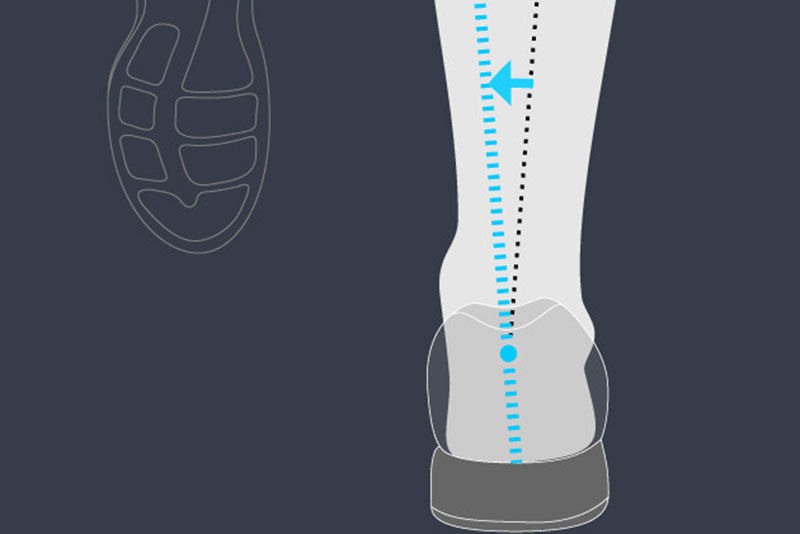 What is pronation and why does it matter?