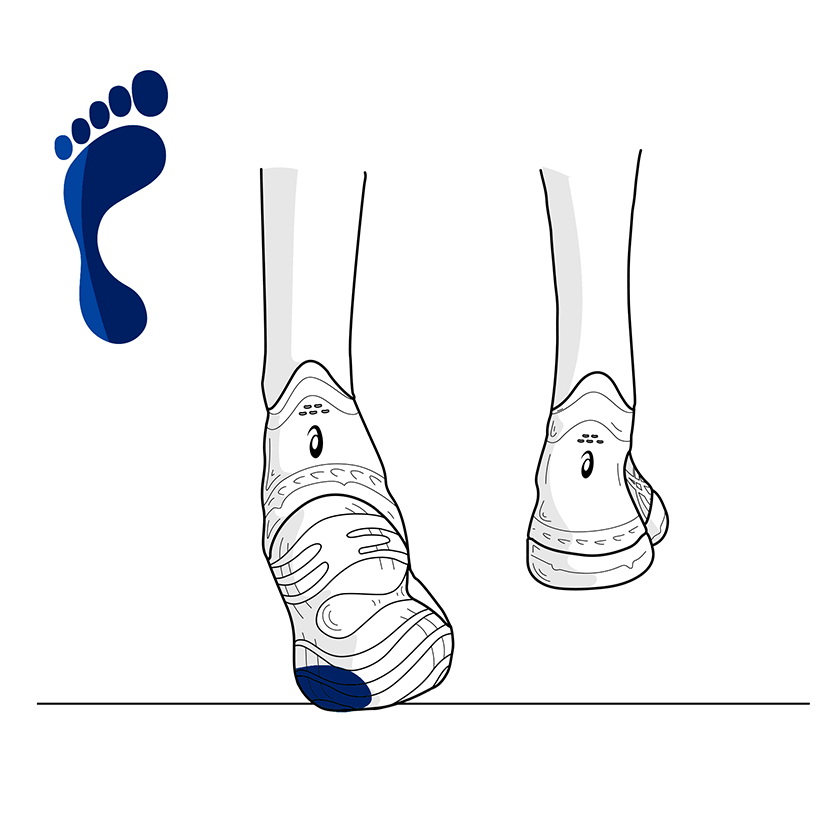 Supination and Footwear: Effects on the Body